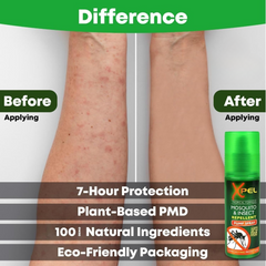 Xpel Mosquito & Insect Repellent Green Bundle | Pump Spray, Roll On, 2pin Plug-In