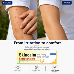 Skincalm Hydrocortisone 1% Bite & Sting Relief Cream 10g