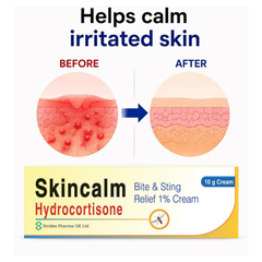 Skincalm Hydrocortisone 1% Bite & Sting Relief Cream 10g